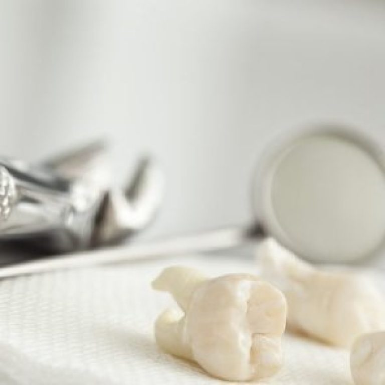 implantodent-chisinau-centru-chirurgie-dentara