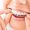 prozirni-aparatic-medikadent-aligner-1024x627
